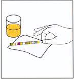 Тест-смужки URISCAN U11 Protein Strip (визначення білка в сечі) No50, фото 4