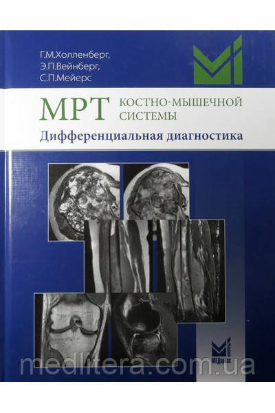 Холленберг Р. М. МРТ кістково-м'язової системи. Диференціальна діагностика