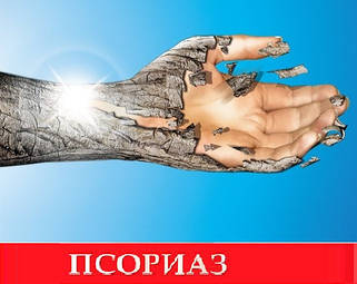 Кошти від псоріазу