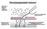 Скрабер для ультразвукового чищення шкіри обличчя та тіла Ultrasonic Anion, фото 6