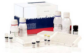 Ingezim APP Mix (10-12). Тест-система для підрахунку специфічних антитіл до вірусу Actinobacillus pleuropneum