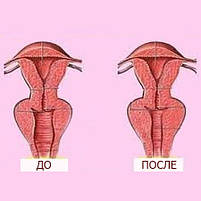 VagiTonus - Крем-гель для звуження піхви (ВагиТонус), фото 3