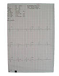 Термопапір для кардіографа BIOSET 9000, фото 2