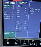 Апарат ШВЛ для новонароджених GE Engstrom Carestation Ventilator, фото 10