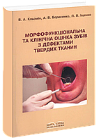 Морфофункціональна та клінічна оцінка зубів з дефектами твердих тканин. Кльомін В. А.