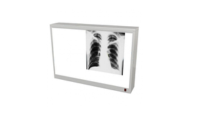 Негатоскопи