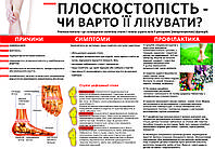 Санбюлетень "Плоскостопість чи варто її лікувати" Пластик, А2 (600*420 мм)