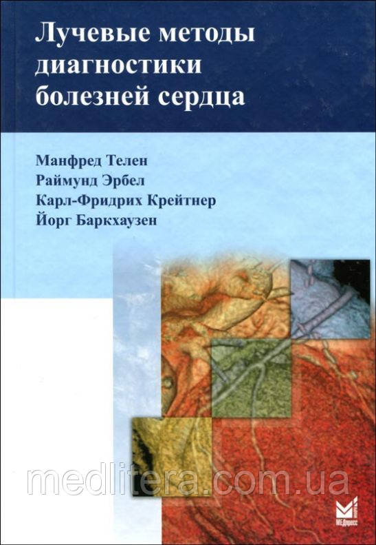 М. Телен, Р. Эрбел, К.-Ф. Крейтнер Променеві методи діагностики хвороб серця