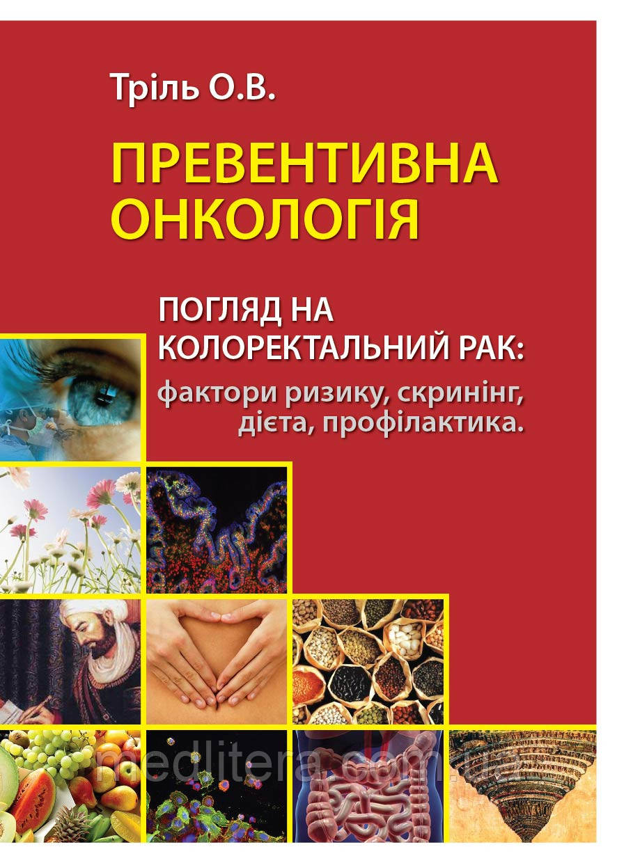 Тріль О. Превенивна онкологія. Погляд на колоректальний рак: фактори ризику, скринінг, дієта, профілактика