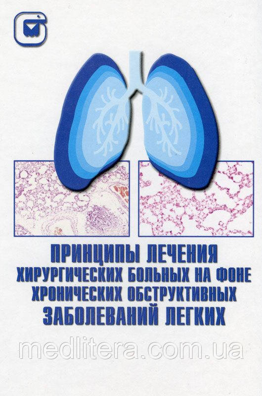 Гірін О. Н. Принципи лікування хірургічних хворих на тлі хронічних обструктивних захворювань легень
