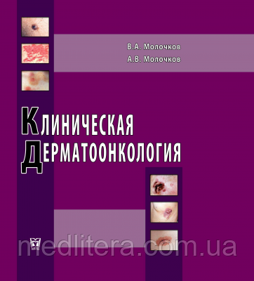 Молочков Ст. А, Молочков А. В. Клінічна дерматоонкология