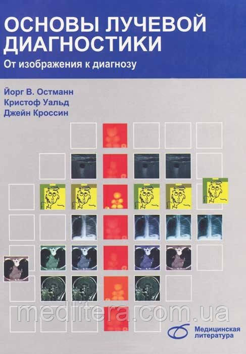 Остманн Й. Основи променевої діагностики. Від зображення до діагнозу