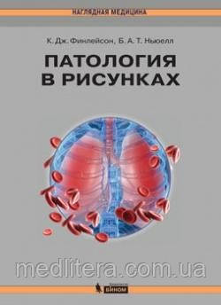 Фінлейсон К. Дж., Ньюелл Баррі А. Т. Патологія в малюнках
