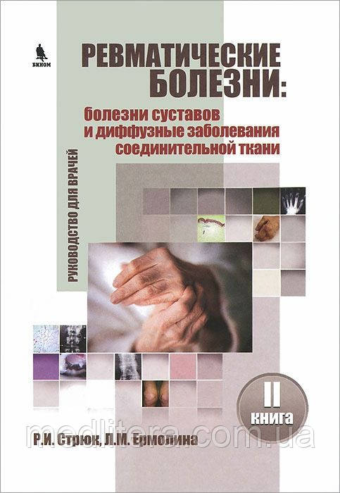 Стрюк Р. Ревматичні хвороби: хвороби суглобів і дифузні захворювання сполучної тканини. Книга 2