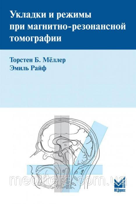 Торстен Б. Меллер, Е. Райф. Укладання і режими при магнітно-резонансної томографії 2018 рік