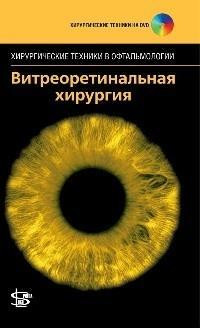 Абдхіш Р. Бахавсар Вітреоретинальна хірургія