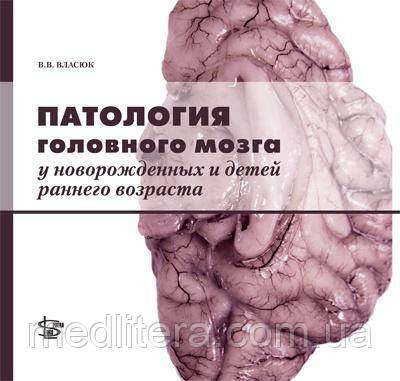 Власюк В. В. Патологія головного мозку у новонароджених та дітей раннього віку