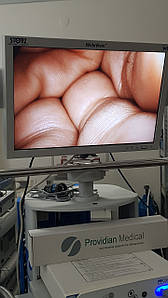 Монітор медичний хірургічний NDS 23 дюйми. Full HD (США)