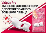 Гелевий коректор великого пальця Valgus Pro (Valgus Plus, Altus Pro) — лікування кісточки, фото 3