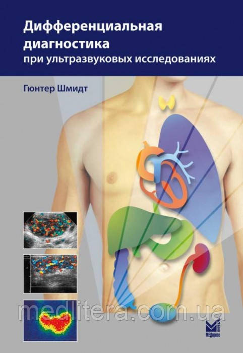 Шмідт Р. Диференціальна діагностика при ультразвукових дослідженнях 2020 рік