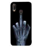 Чехол накладка силиконовая для Huawei Huawei p20 lite с рисунком рентген руки