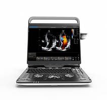 Ультразвуковий сканер Ebit 60