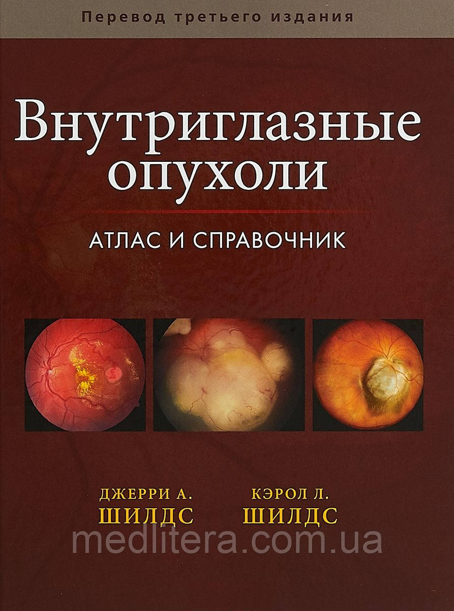 Джеррі А. Шилдс, Керол Л. Шилдс. Внутрішньоочні пухлини. Атлас і довідник 2500 иллюстрацій