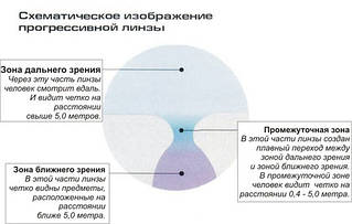 Прогресивні лінзи