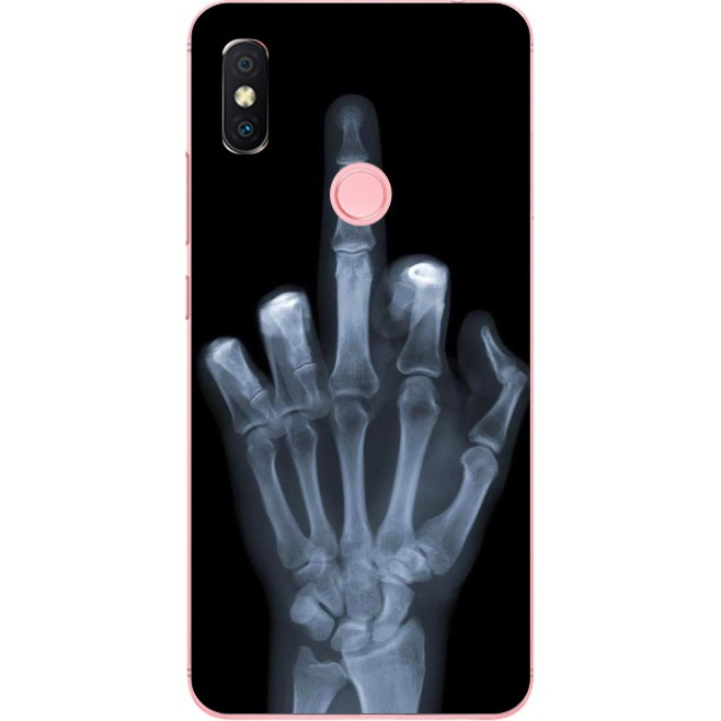 Силіконовий бампер для Huawei P Smart Plus з малюнком Рентген