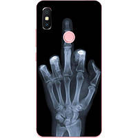 Силіконовий бампер для Huawei P20 Lite з малюнком Рентген