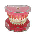 Моделі зубів верхньої та нижньої щелеп, фото 2