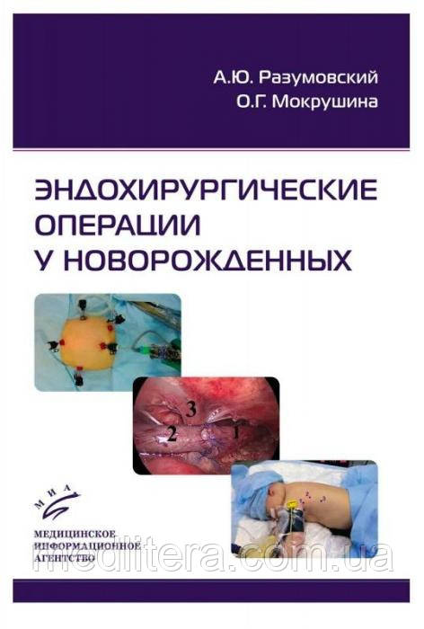 Розумовський А. Ю., Мокрушина О. Р. Ендохірургічні операції у новонароджених