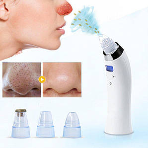 Вакуумне очищення обличчя Comedo Suction 4 насадки