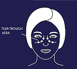 Концентрована сироватка для шкіри навколо очей Hydra System Expert Інтенсивний Гіалуронік Institut Esthederm,15ml, фото 6