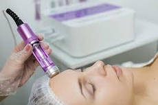 Електропорація