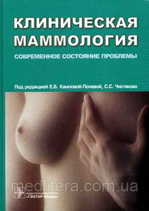 Кампова-Польова Е. Б., Чистяков С. С. Клінічна мамологія.Сучасний стан проблеми
