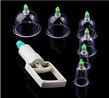 Набір вакуумних чаш 6 шт., фото 3