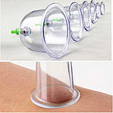 Набір вакуумних чаш 6 шт., фото 4