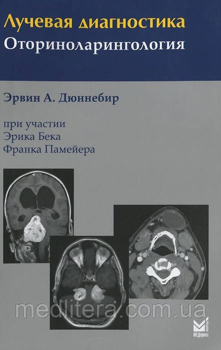 Ервін А. Дюннебир. Променева діагностика. Оториноларингологія 3-е видання 2022 рік