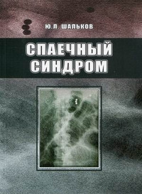 Шальков Ю. К. Спайковий синдром