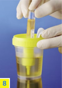 Емкость (контейнер) Urintransfe для вакуумного забора мочи 120 мл стерил. - фото 2 - id-p13100938