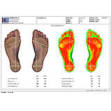 Підосканер для діагностики стоп 2D FootCAD + програмне забезпечення FreeStep BASIC, фото 5