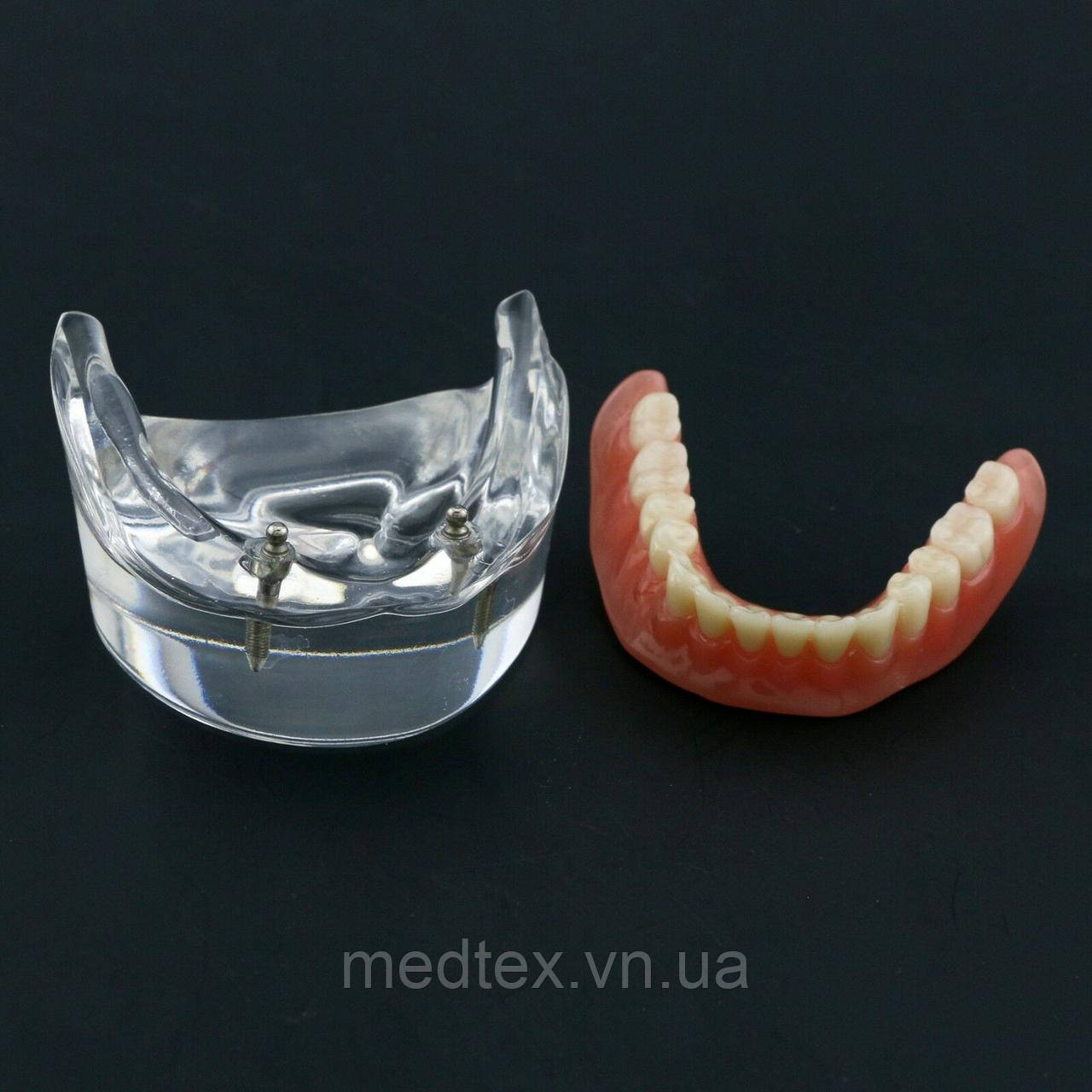 Демонстраційна модель зубів.