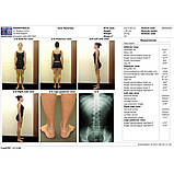 Система відеографії 2D для діагностики постави тіла та ходи, фото 3