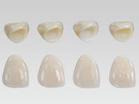 Маса дентину IPS e.max Ceram Е.макс Церам Dentin 20 g А1,A2- D3; TI1-TI3, ddA1-D3