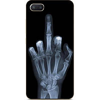 Силиконовый чехол для Iphone 7 plus с рисунком Рентген