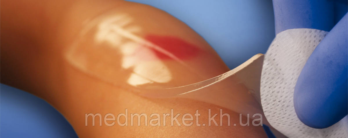 Гидрогелевая стерильная повязка KiKgеl AQUA-GEL 10x12 см (5 шт в упаковке) - фото 4 - id-p926830088