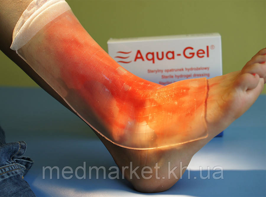Гидрогелевая стерильная повязка KiKgеl AQUA-GEL 10x12 см (5 шт в упаковке) - фото 5 - id-p926830088