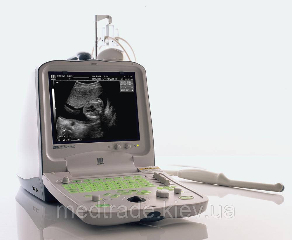 Ультразвуковий портативний сканер Mindray DP-3300