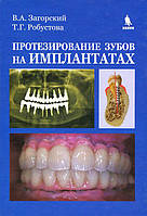 Валерий Загорский, Татьяна Робустова Протезирование зубов на имплантатах